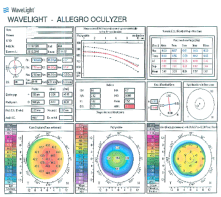 Topographie Pentacam